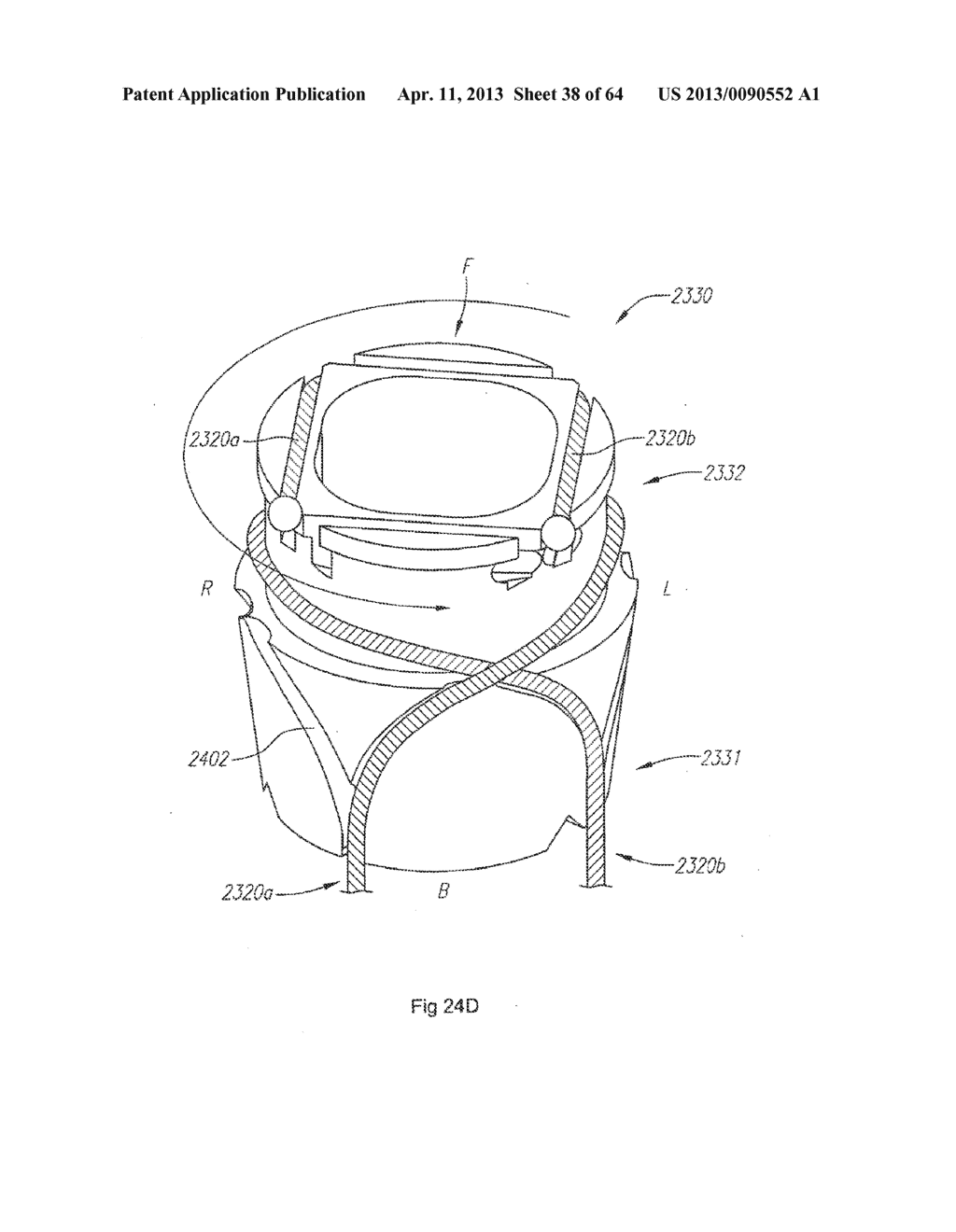 SYSTEM AND METHOD FOR SENSING SHAPE OF ELONGATED INSTRUMENT - diagram, schematic, and image 39