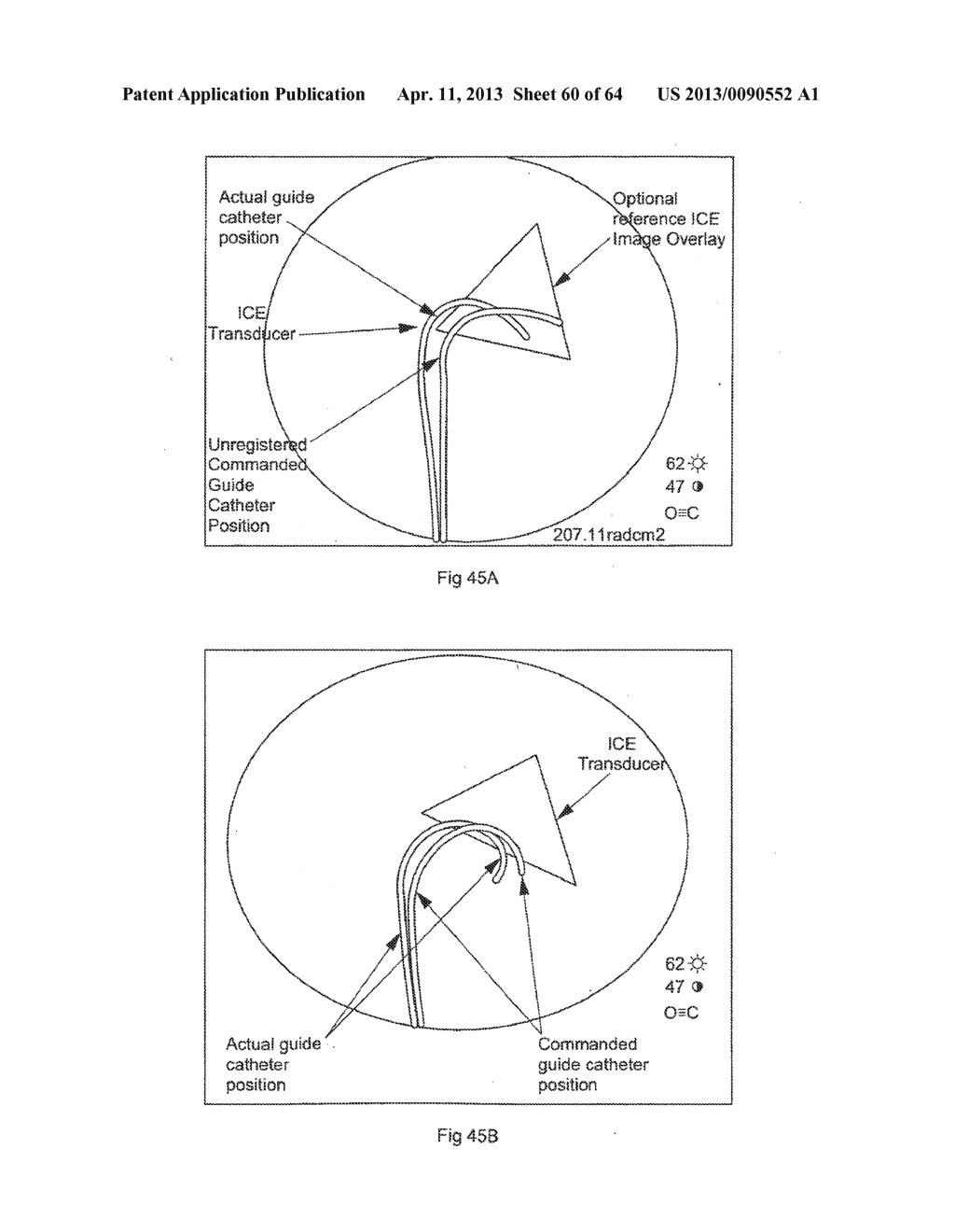 SYSTEM AND METHOD FOR SENSING SHAPE OF ELONGATED INSTRUMENT - diagram, schematic, and image 61