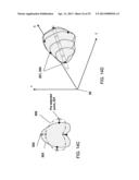 FOCUSED PROSTATE CANCER TREATMENT SYSTEM AND METHOD diagram and image