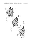 FOCUSED PROSTATE CANCER TREATMENT SYSTEM AND METHOD diagram and image