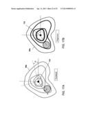 FOCUSED PROSTATE CANCER TREATMENT SYSTEM AND METHOD diagram and image