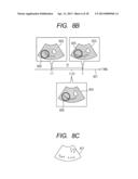 ULTRASOUND IMAGE RECONSTRUCTION METHOD, DEVICE THEREFOR, AND ULTRASOUND     DIAGNOSTIC DEVICE diagram and image