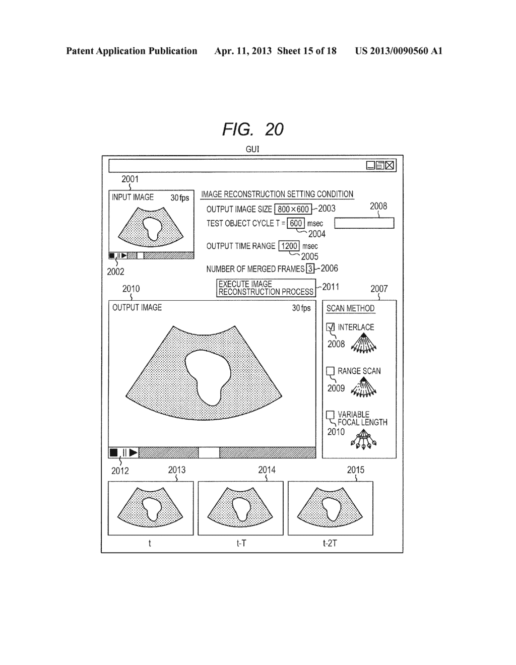 ULTRASOUND IMAGE RECONSTRUCTION METHOD, DEVICE THEREFOR, AND ULTRASOUND     DIAGNOSTIC DEVICE - diagram, schematic, and image 16