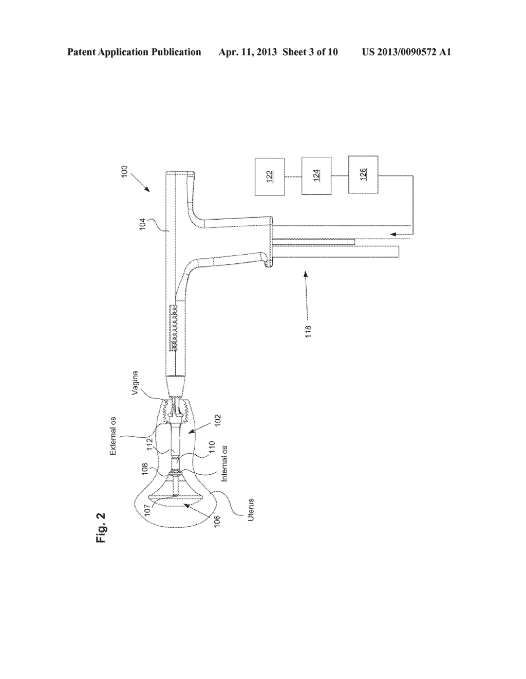 Integrity Testing Method and Apparatus for Delivering Vapor to the Uterus - diagram, schematic, and image 04