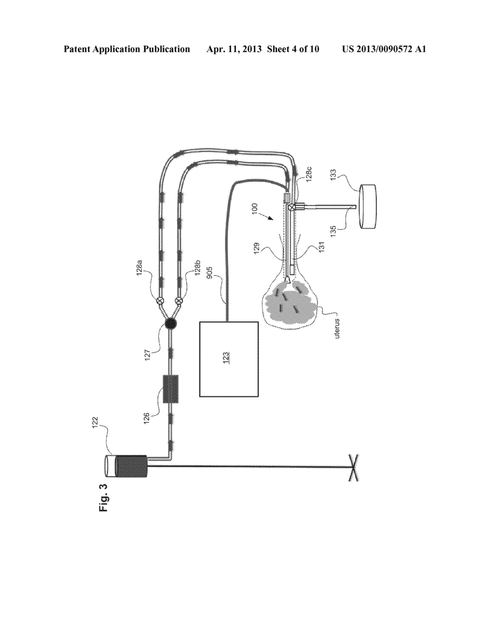 Integrity Testing Method and Apparatus for Delivering Vapor to the Uterus - diagram, schematic, and image 05