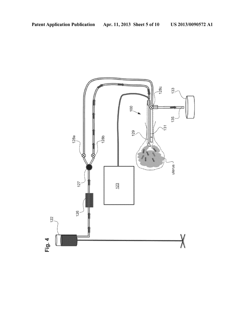 Integrity Testing Method and Apparatus for Delivering Vapor to the Uterus - diagram, schematic, and image 06