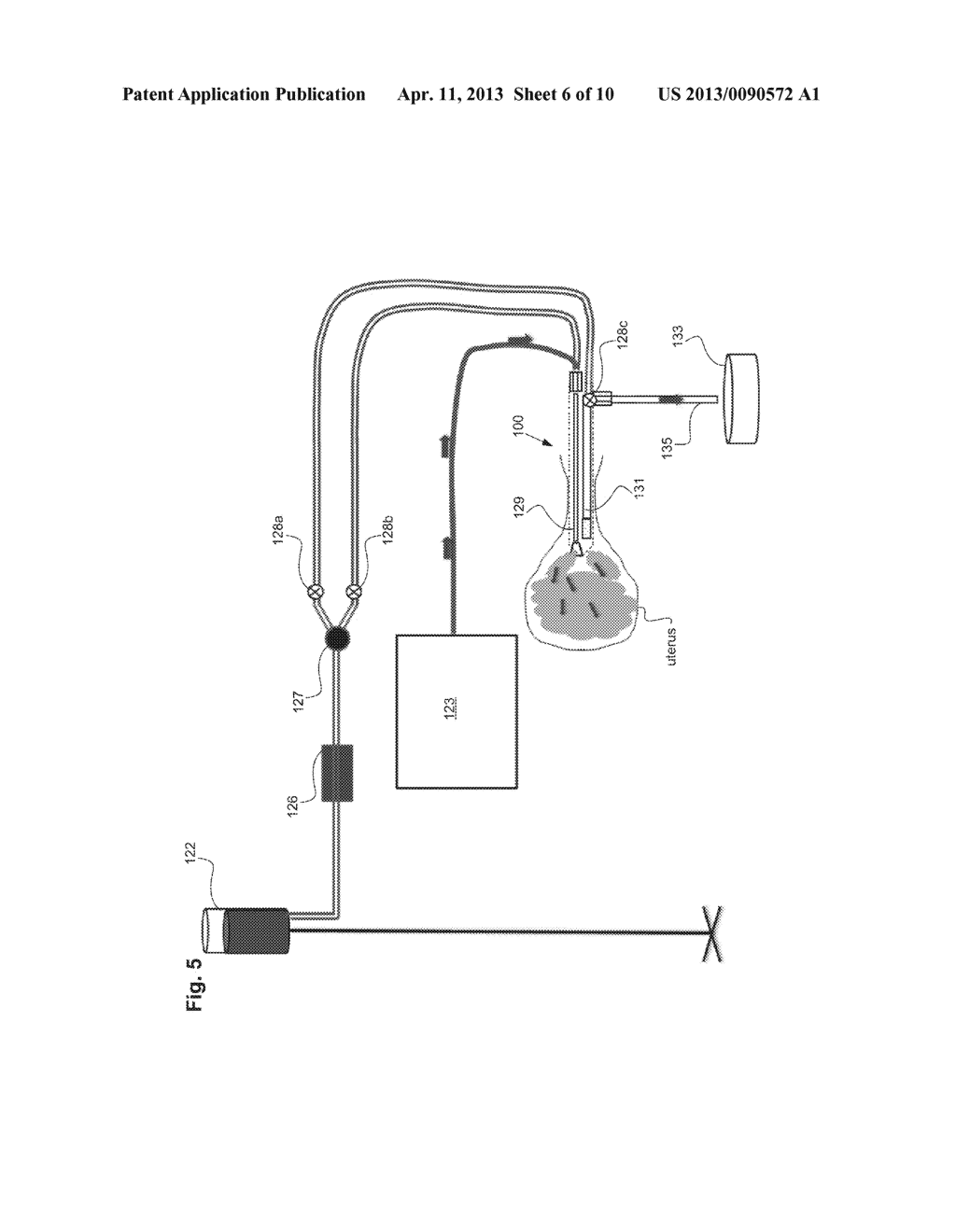 Integrity Testing Method and Apparatus for Delivering Vapor to the Uterus - diagram, schematic, and image 07