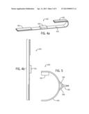 DETECTION AND TREATMENT OF ABNORMAL ESOPHAGEAL SPHINCTER FUNCTIONALITY diagram and image