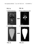 Pulsed Cavitational Therapeutic Ultrasound With Dithering diagram and image