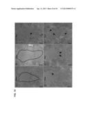 Pulsed Cavitational Therapeutic Ultrasound With Dithering diagram and image