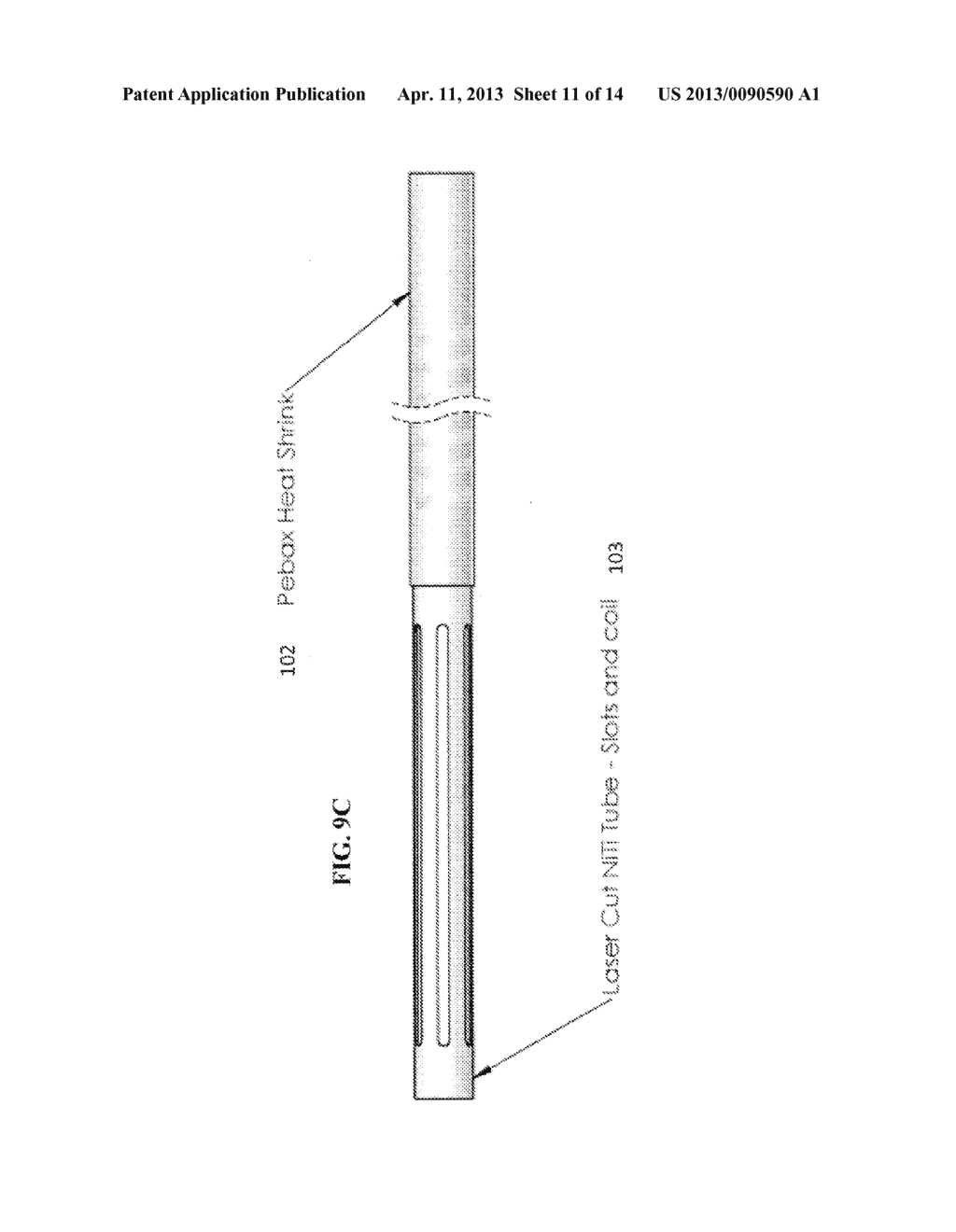 Methods and Apparatus for Treating Obesity and Diabetes - diagram, schematic, and image 12