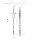 Methods and Apparatus for Treating Obesity and Diabetes diagram and image