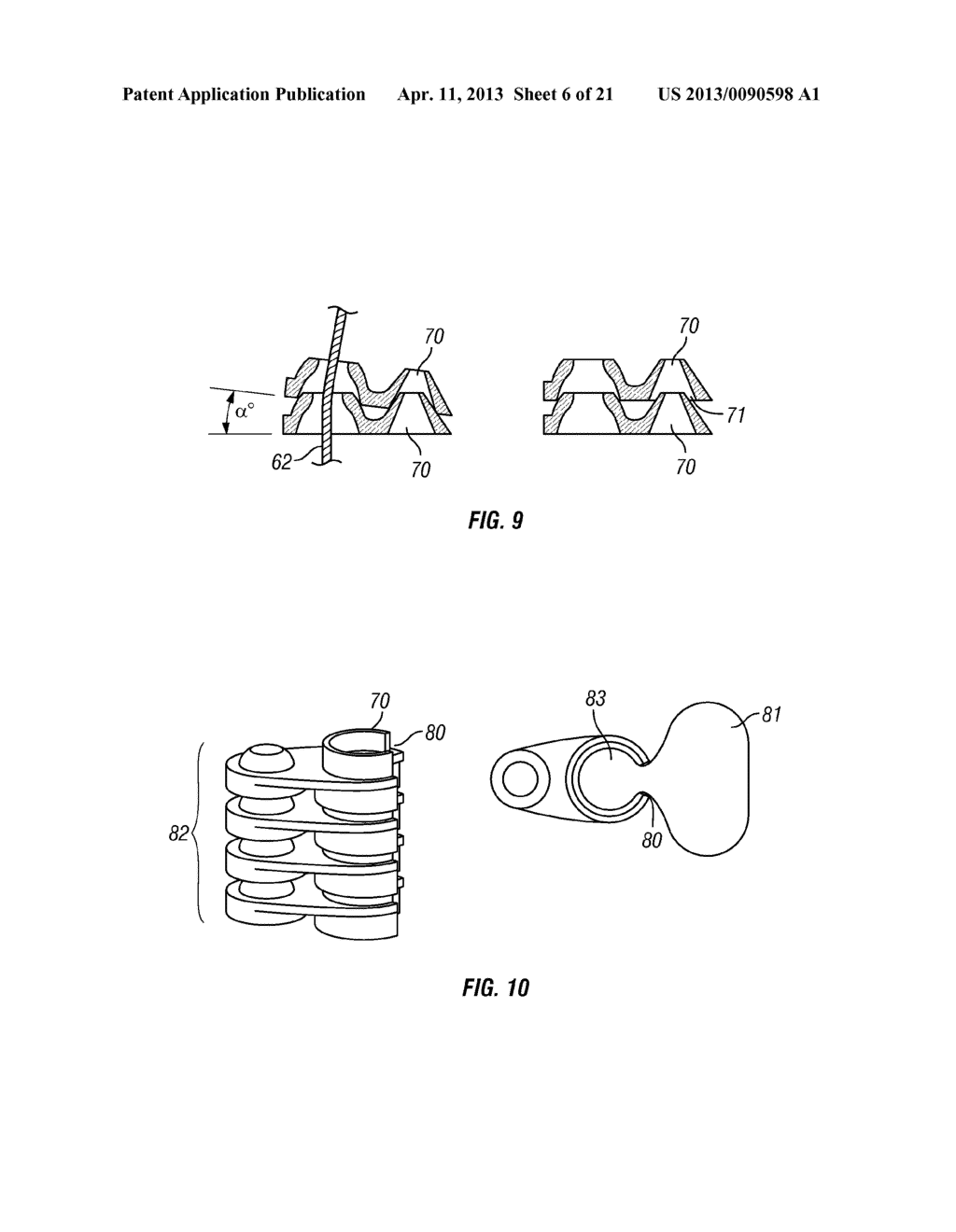 SHAPE-TRANSFERRING CANNULA SYSTEM AND METHOD OF USE - diagram, schematic, and image 07