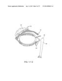 Ocular Insert Apparatus and Methods diagram and image