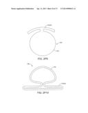 Ocular Insert Apparatus and Methods diagram and image