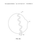 Ocular Insert Apparatus and Methods diagram and image