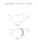 Ocular Insert Apparatus and Methods diagram and image