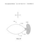 Ocular Insert Apparatus and Methods diagram and image