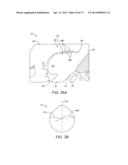 Ocular Insert Apparatus and Methods diagram and image