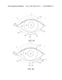 Ocular Insert Apparatus and Methods diagram and image