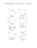 Ocular Insert Apparatus and Methods diagram and image