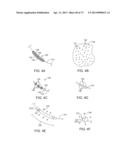 Ocular Insert Apparatus and Methods diagram and image