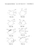 Ocular Insert Apparatus and Methods diagram and image