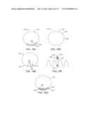 Ocular Insert Apparatus and Methods diagram and image