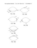 Ocular Insert Apparatus and Methods diagram and image