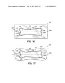 DISPOSABLE ABSORBENT PRODUCT WITH SHAPED FLUID STORAGE STRUCTURES diagram and image