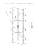 DEVICE AND METHODS FOR RENAL NERVE MODULATION diagram and image