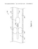 DEVICE AND METHODS FOR RENAL NERVE MODULATION diagram and image