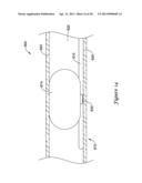 DEVICE AND METHODS FOR RENAL NERVE MODULATION diagram and image