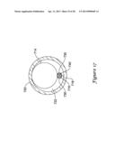 DEVICE AND METHODS FOR RENAL NERVE MODULATION diagram and image