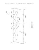 DEVICE AND METHODS FOR RENAL NERVE MODULATION diagram and image