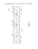 DEVICE AND METHODS FOR RENAL NERVE MODULATION diagram and image