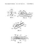 ULTRASONIC OSTEOTOME diagram and image