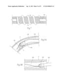 ATHERECTOMY DEVICES AND METHODS diagram and image