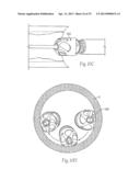 ATHERECTOMY DEVICES AND METHODS diagram and image