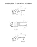 ATHERECTOMY DEVICES AND METHODS diagram and image