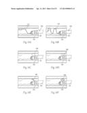 ATHERECTOMY DEVICES AND METHODS diagram and image