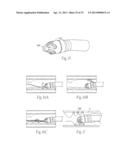 ATHERECTOMY DEVICES AND METHODS diagram and image