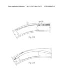 ATHERECTOMY DEVICES AND METHODS diagram and image