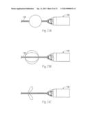 ATHERECTOMY DEVICES AND METHODS diagram and image