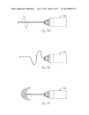 ATHERECTOMY DEVICES AND METHODS diagram and image