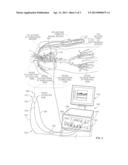 Operating A Vessel Occlusion Catheter diagram and image