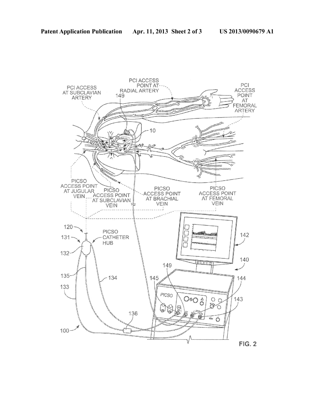 Operating A Vessel Occlusion Catheter - diagram, schematic, and image 03