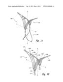 DEVICES, SYSTEMS AND METHODS FOR ENCLOSING AN ANATOMICAL OPENING diagram and image