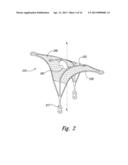 DEVICES, SYSTEMS AND METHODS FOR ENCLOSING AN ANATOMICAL OPENING diagram and image