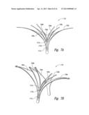 DEVICES, SYSTEMS AND METHODS FOR ENCLOSING AN ANATOMICAL OPENING diagram and image